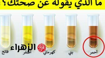 «مؤشر لمرض خطير».. احذر من ظهور هذه العلامة على لون البول | أوعى تتجاهلها