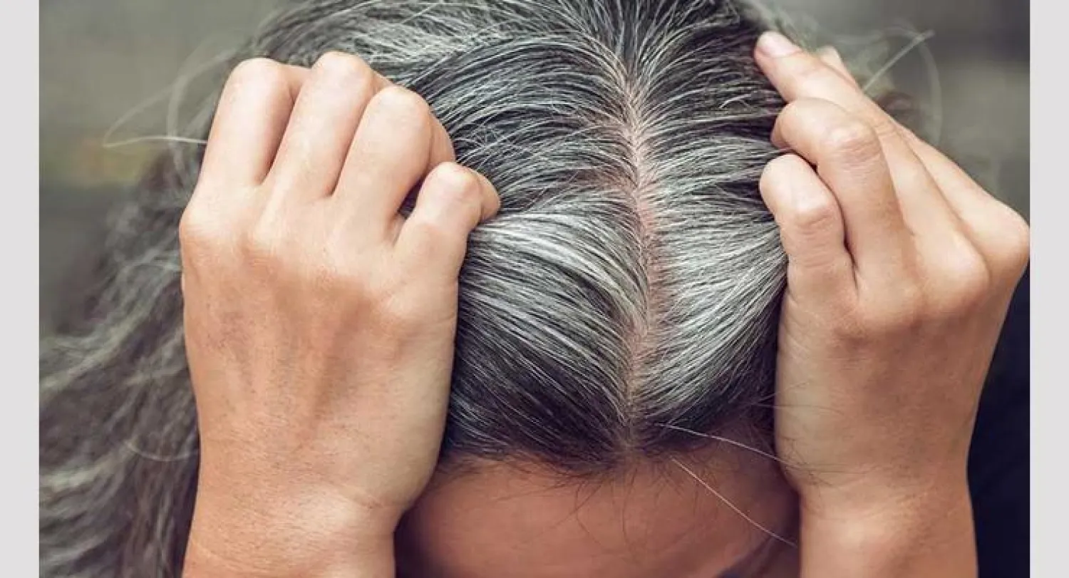 وداعاً للصبغات.. اكتشاف علاج ثوري للتخلص من الشعر الأبيض